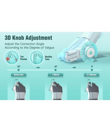 Adjustable Silicone Hallux Valgus Correctors - 2 Pieces for Left & Right Feet | Orthotic Solutions - Buy Online on GoSupps.com