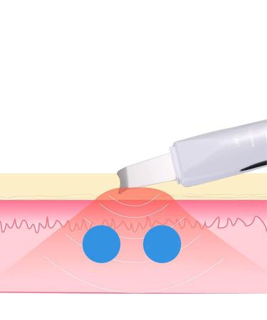 Skin Spatula Blackhead Remover | Deep Cleansing Face Scrubber | Moisturizing Beauty Lifting Tool - Buy Online on GoSupps.com