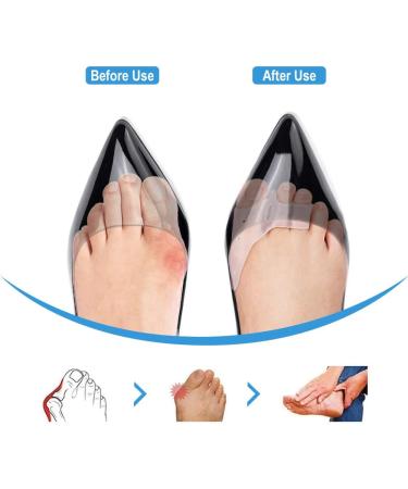 Bunion Corrector & Toe Separator Set for Hallux Valgus - 2 Pairs - Buy Online on GoSupps.com