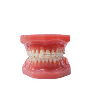 Dental Typodont With Ceramic Brackets Orthodontic Braces Teeth Model 28pcs Teeth Ceramic Braces Model For Teaching Practice