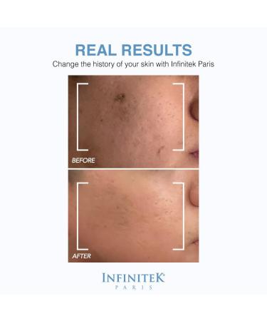 Infinitek Paris Organic Hyaluronic Acid Serum - Hydrating Anti-Aging Face Moisturizer - 1 Fl Oz for Radiant Skin - Buy Online on GoSupps.com