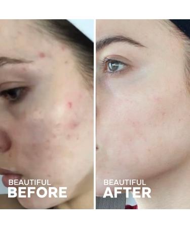 Dew Drops Hyaluronic Acid & Vitamin C Serum - Vegan Facial Serum - Brightening & Plumping - 1 Fl Oz - Buy Online on GoSupps.com