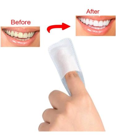 ANGGREK 50Pcs Dental Wipes - Effective Oral Deep Cleaning Tooth Care Tool for Fresh Breath - Buy Online on GoSupps.com