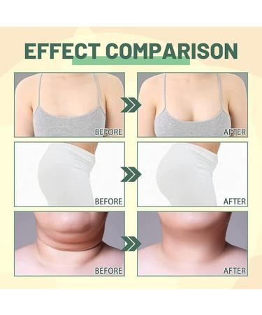 (100% Effective) 5Pcs Anti Aging Collagen Serum Collagen Compact Body Oil Beauty Women Collagen Lifting Body Oil Skincare Body Oil Reduces Fine Lines and Wrinkles - Buy Online on GoSupps.com