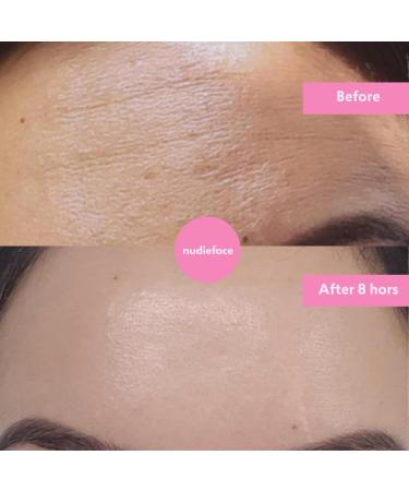 Notox Forehead + Frown Lines - Nudie Face - 100% Medical Grade Silicone Wrinkle Patch - Reusable Silicone Face Patch To Reduce Fine Lines and Wrinkles - Wrinkle Smoothing - Fast Results - Buy Online on GoSupps.com