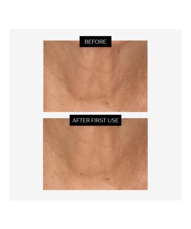 Perlier Black Rice Eye Serum Anti-Aging Moisturizing Gel Fine Line Reducer With Organic Black Rice Extract Light Texture Formula 2-Pack1.5 fl oz each - Buy Online on GoSupps.com