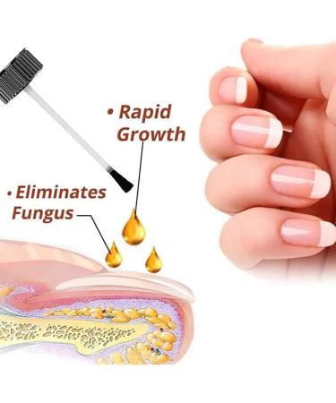 Buy Tlopa Nail Growth and Strengthening Serum - Nail Repair Solution (2 Pieces) for Stronger Healthier Nails Worldwide - Buy Online on GoSupps.com