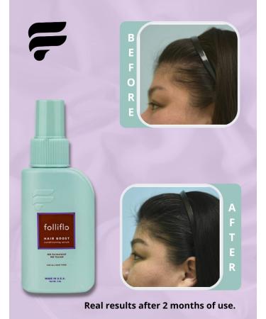 Folliflo Hair Boost Leave-In Conditioner Spray Serum - Hair Growth & Shedding Treatment - Buy Online on GoSupps.com