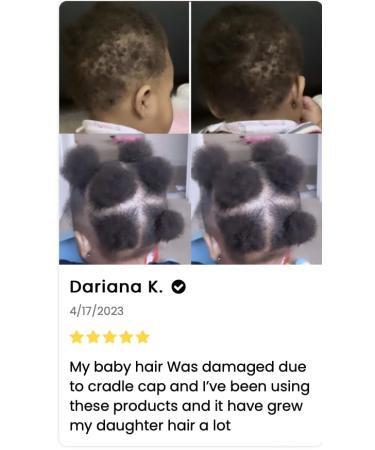J Organic Solutions Kids Biotin Growth Stimulating Conditioner | 8oz with Argan Oil & Aloe Vera - International Shipping Available - Buy Online on GoSupps.com