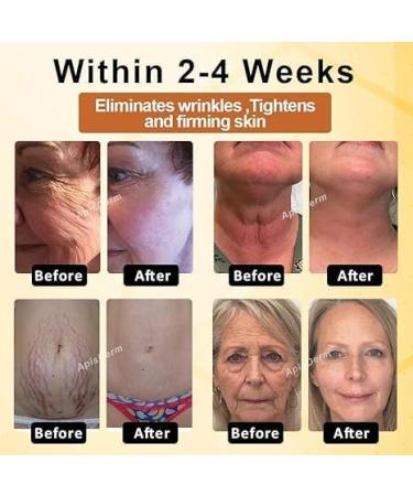 Kanoauo Apisderm Botoxbee Advanced MultiAction Festing Cream Bee strengthening cream advanced fortressing and wrinkle reduction cream for all skin types 100 g - Buy Online on GoSupps.com