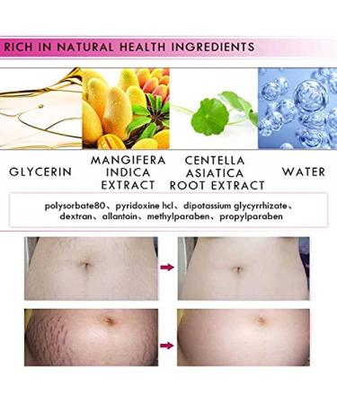 Mango Stretch Marks & Scar Removal Cream - Pregnancy & Obesity Relief (40g - Buy Online on GoSupps.com