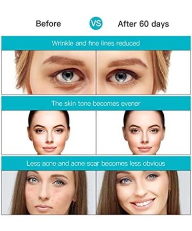 LED Face Mask Light Therapy Anti Acne 7 Color Photonic Mask for Skin Rejuvenation (Beige) - Buy Online on GoSupps.com