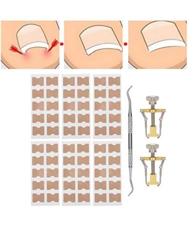 9Pcs Ingrown Toenail Corrector Strips Ingrown Toenail Treatment Strips Brace Foot Care Tool Kit Paronychia Toe Nail Fixer Pedicure Tool Nail Toenail Corrector Sticker Nail - Buy Online on GoSupps.com