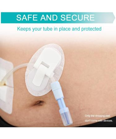 EaseToU Feeding Tube Cover Pack of 5 - Catheter Fixation Pads for J Peg, Foley Drain & Peritoneal Dialysis - Stabilization Device Accessories - Buy Online on GoSupps.com