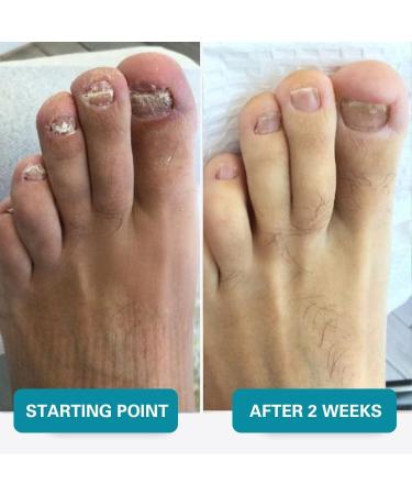 Norelie Antifungal Cream 100g Moisturizing Skin Cream with Phellodendron Sophora Aloe Vera & Ginkgo Non-Greasy Plant-Based Formula for Dry Skin Care - Buy Online on GoSupps.com