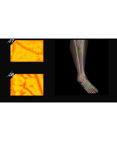 Oiakus Venous Imaging Scarves for Adults & Children | Medical Vein Support for Hospitals Clinics & Home Use - Buy Online on GoSupps.com