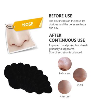 Nosestripes Blackhead Clearing Strips - 25 Pieces for Men & Women | Pore Strip Solution for Clear Skin - Buy Online on GoSupps.com