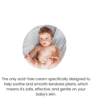 KPAWAY Keratosis Pilaris Treatment Emollient 16oz - Baby Friendly Formula - Buy Online on GoSupps.com
