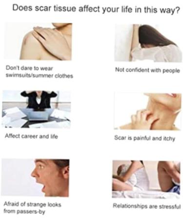 Scar Removal Cream - Acne Scar Treatment Serum for Smooth & Delicate Skin 20mL - Buy Online on GoSupps.com
