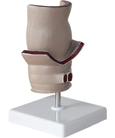 Rectal Pathology Model hemorrhoid Model proctology retal Disease Demonstration 5X Anal Anal and Anal Canal Model Anal and anorect Rectal 11 * 11 * 18.5cm - Buy Online on GoSupps.com