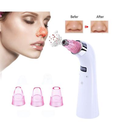 Blackhead Remover Electric Rechargeable Facial Pore Cleanser Exfoliating Cleansing Skin Acne Extractor for Facial Skin Cleansing