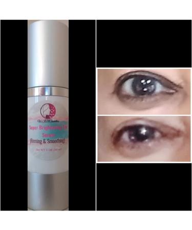Advanced Anti-Aging Eye Treatment Serum for Rapid Reduction of Under-Eye Bags, Wrinkles, and Fine Lines - Brightening Formula with Niacinamide and Hyaluronic Acid - Buy Online on GoSupps.com