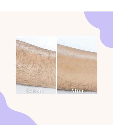 Crystal Hair Eraser - Pain-Free Hair Removal Tool for Men and Women | Skin Exfoliator and Epilator - Reusable (Pink) - Buy Online on GoSupps.com