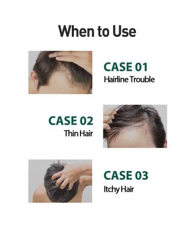 Dashu Anti-Hair Loss Herb Tonic | 150ml Hair Growth Solution - Buy Online on GoSupps.com