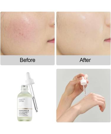 TUKNN Hyaluronic Acid Dark Spot Remover for Face Hyaluronic Acid Serum for hydrated Hyalu B5 Serum Hyaluronic Acid Serum for Face Anti Aging Serum for Face Hyaluronic Acid Hydrating Serum 30ml - Buy Online on GoSupps.com