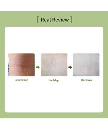 OxygenCeuticals Skin Barrier Ato Cream Protective Cream with Fucoidan V, Shea Butter & Centella Asiatica, Strengthen Skin Barrier & Soothe Sensitive Skin. 4.05 fl.oz (120ml) 4.1 Fl Oz (Pack of 1) - Buy Online on GoSupps.com