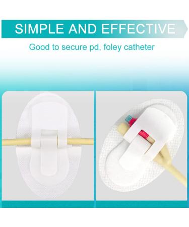 EaseToU Feeding Tube Cover Pack of 5 - Catheter Fixation Pads for J Peg, Foley Drain & Peritoneal Dialysis - Stabilization Device Accessories - Buy Online on GoSupps.com