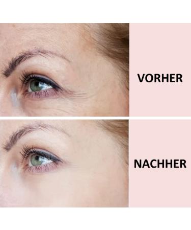 2in1 Sandy Skin Reusable Cheek Folds Pads & Free Eye Pads | Anti-Fold Solution for Face & Eyes | Global Shipping - Buy Online on GoSupps.com