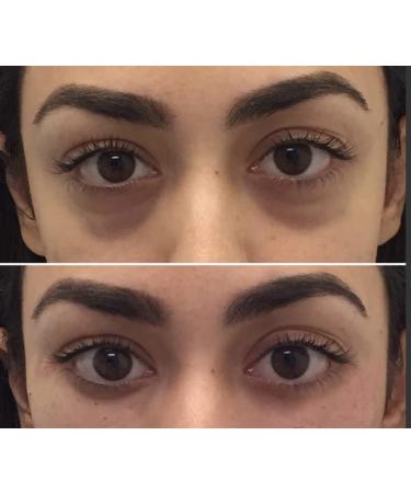 Bellmona Bio Signal Eye Cream - Brighten & Revitalize | International Shipping Available - Buy Online on GoSupps.com