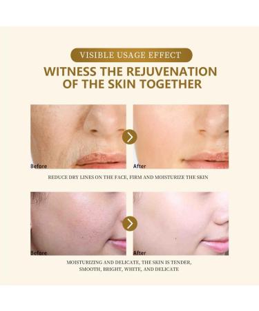 Ginseng Essence Anti-Wrinkle Serum - Moisturizing and Firming Essential Oil with Ginseng Extract Herbal Ginseng Anti-aging Essence Reduces Fine Lines and Wrinkles Smoothes Skin 4.23 Fl Oz - Buy Online on GoSupps.com