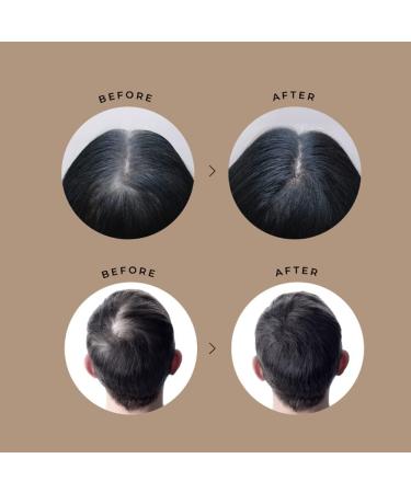 Vita Hair Growth & Hair Loss Supplement - 100% Natural Herbs for Thinning & Greying Hair - Stimulates New Hair Follicles - Men/Women - 90 Capsules - Buy Online on GoSupps.com