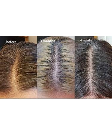 The Ordinary Multi-Peptide Serum for Hair Density - 60 ml | Enhance Hair Growth & Thickness - International Shipping Available - Buy Online on GoSupps.com