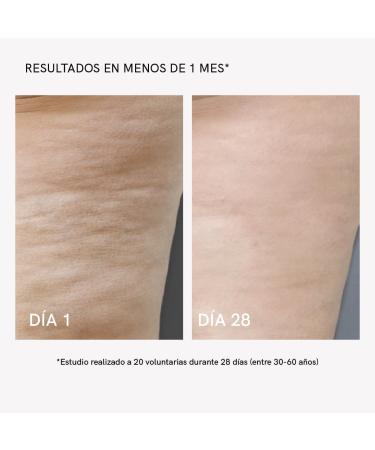 MASDERM Professional Body Radio Frequency Device | Cellulite Massager | Cavitation & Radio Frequency | Ultrasound Machine | Flaccidity Treatment | Galvanic | Hifu Machine - Buy Online on GoSupps.com