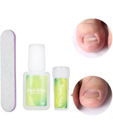 Ingrown Toenail Correction Kit Ingrown Toenail Patch Correction Kit Elastic Toe Nail Straightener Patch with Nail File Glue - Buy Online on GoSupps.com