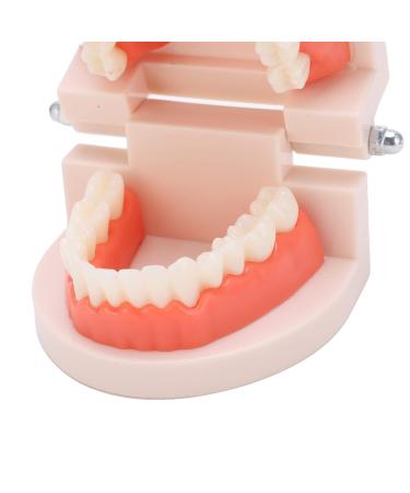 Teeth Model - Anti-Yellow Denture Model for Hospitals & Kindergartens | Shop Internationally - Buy Online on GoSupps.com