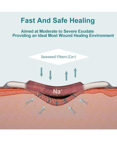 Winner Medical Calcium Alginate Wound Dressing Pads 4'' x 4'' - Box of 10 | Sterile, Antimicrobial, Highly Absorbent | Non-Stick, Flexible & Gentle - Faster Healing - Buy Online on GoSupps.com