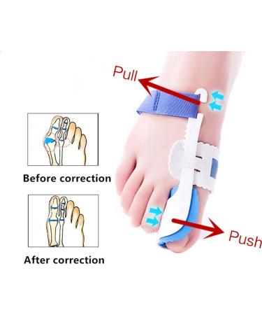 Buy LTLCLZ Toe Separator for Hallux Valgus - 2 Pack Bunion Corrector & Toe Correction Finger Separator - Buy Online on GoSupps.com