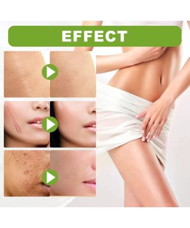 30ml Goopgen Medical Grade Scar Repair Serum - Nature Scar Treatment for All Types of Scars (1pcs) - Buy Online on GoSupps.com