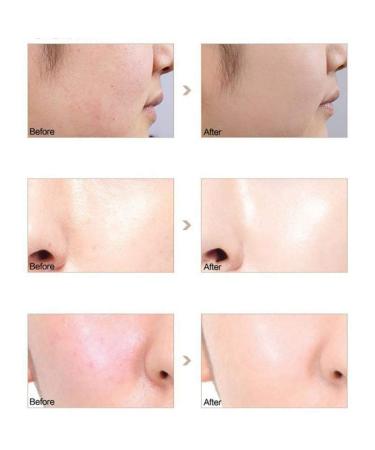 6-Piece Liquid Foundation Set | Matte Full Coverage Makeup with Primer Oil Rollers Brush & Sponge - #101 - Buy Online on GoSupps.com