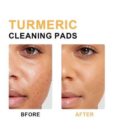 Turmeric Kojic Acid Cleansing Pads | Exfoliating Facial Sponges - 40 Count for Bright & Clear Skin - Buy Online on GoSupps.com