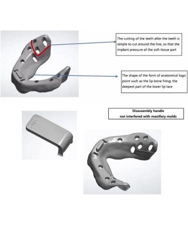 Molding Complete Prothese Teeth Trays | Dental Impression Full Mouth Prosthesis Tray - Buy Online Worldwide - Buy Online on GoSupps.com