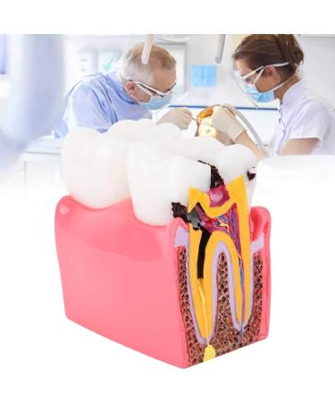 High-Quality Dental Prosthesis Model for Oral Care | International Shipping Available - Buy Online on GoSupps.com