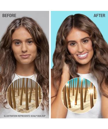 Neutrogena Healthy Scalp Hydro Boost Scrub - Exfoliate & Hydrate with Hyaluronic Acid | International Shipping Available - Buy Online on GoSupps.com