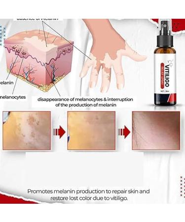 (Quick Effect) 1/2/4pcs & 30ml (4pcs) - Buy Online on GoSupps.com