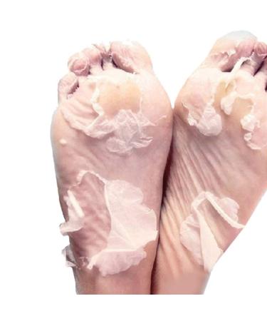 Foot Peel Mask Onkessy Exfoliating Dead Skin Foot Mask Repair Rough Heels for Men Women for Pedicure Spa 1Pair