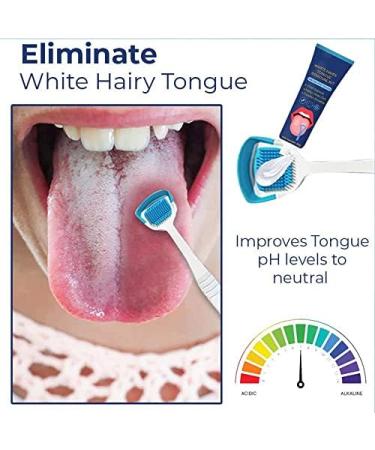 White Hairy Tongue Removal Kit - Tongue Scraper Cleaner Brush & Cleaning Gel for Fresh Breath (1pc) - Buy Online on GoSupps.com